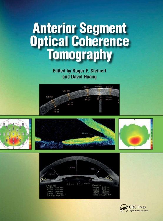 Produktbild: Anterior Segment Optical Coherence Tomography