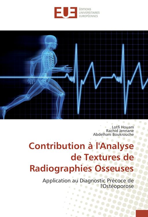 Produktbild: Contribution &agrave; l'Analyse de Textures de Radiographies Osseuses