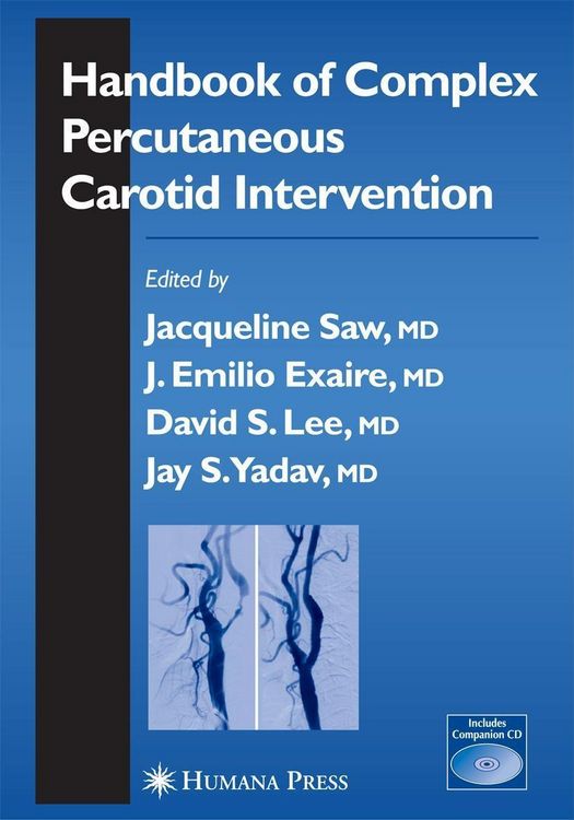Produktbild: Handbook of Complex Percutaneous Carotid Intervention