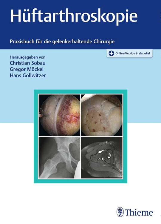 Produktbild: H&uuml;ftarthroskopie
