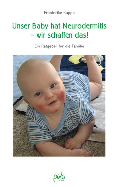 Produktbild: Unser Baby hat Neurodermitis - wir schaffen das!