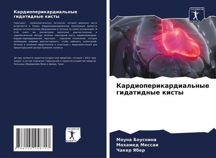 Produktbild: Kardioperikardial'nye gidatidnye kisty