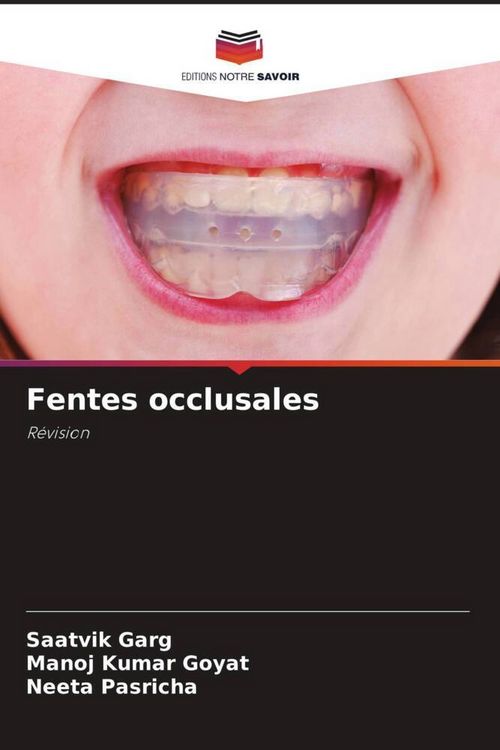 Produktbild: Fentes occlusales