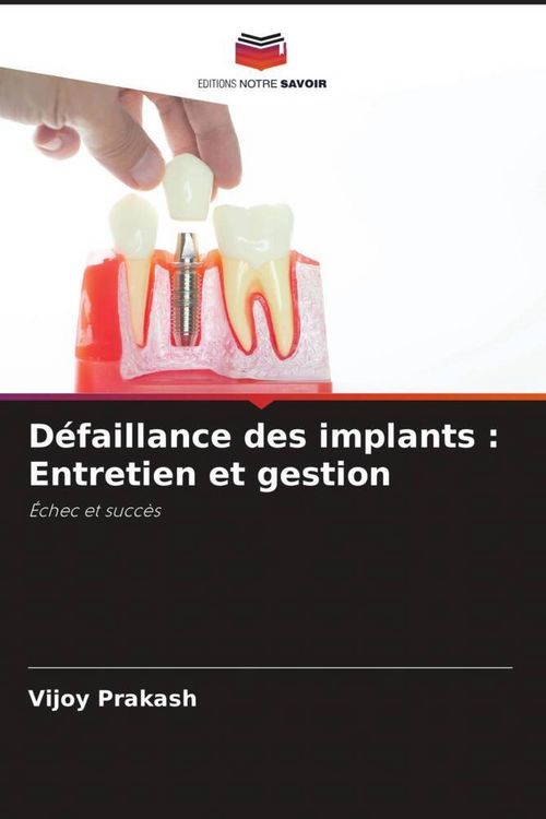 Produktbild: D&eacute;faillance des implants : Entretien et gestion