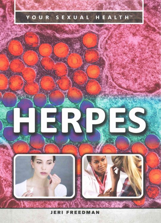 Produktbild: Herpes