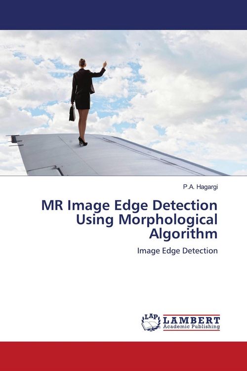 Produktbild: MR Image Edge Detection Using Morphological Algorithm