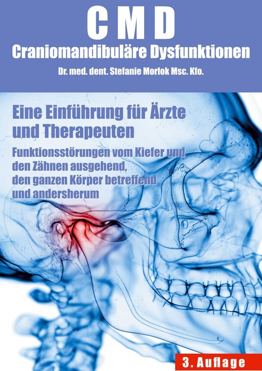 Produktbild: CMD Craniomandibul&auml;re Dysfunktionen