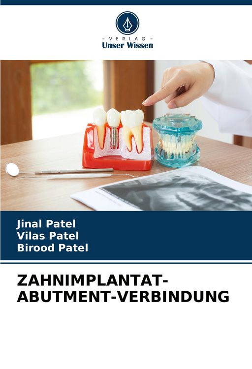 Produktbild: Zahnimplantat-Abutment-Verbindung