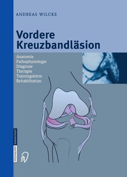 Produktbild: Vordere Kreuzbandl&auml;sion