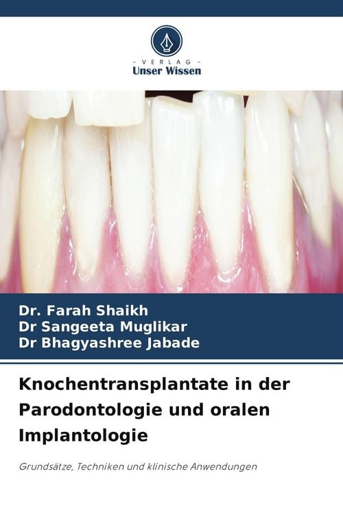 Produktbild: Knochentransplantate in der Parodontologie und oralen Implantologie