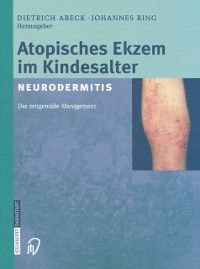 Produktbild: Atopisches Ekzem im Kindesalter (Neurodermitis)