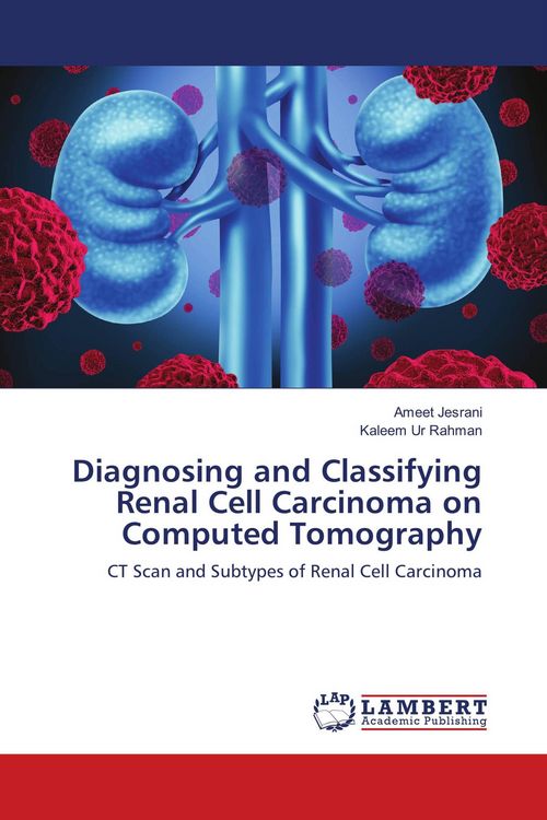 Produktbild: Diagnosing and Classifying Renal Cell Carcinoma on Computed Tomography