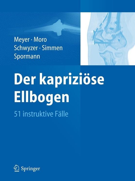 Produktbild: Der kaprizi&ouml;se Ellbogen