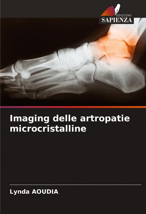 Produktbild: Imaging delle artropatie microcristalline