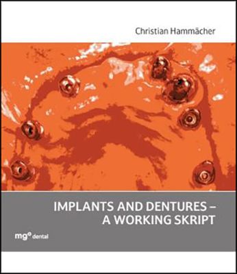 Produktbild: Implants and dentures - a working skript