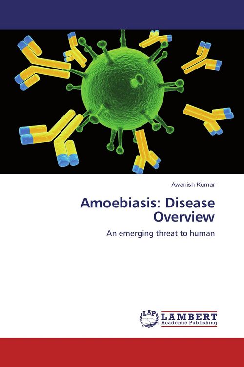 Produktbild: Amoebiasis: Disease Overview