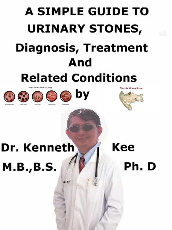 Produktbild: A Simple Guide To Urinary Stones, Diagnosis, Treatment And Related Conditions