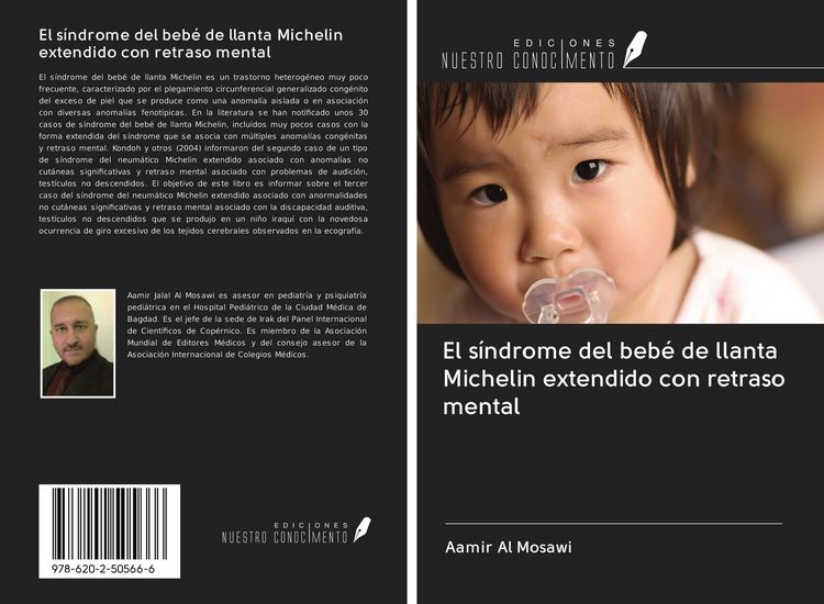 Produktbild: El s&iacute;ndrome del beb&eacute; de llanta Michelin extendido con retraso mental