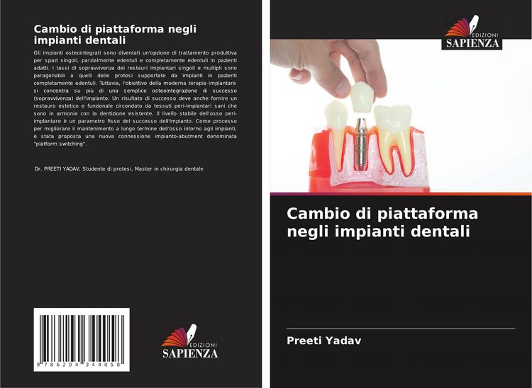 Produktbild: Cambio di piattaforma negli impianti dentali