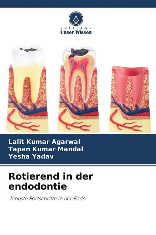Produktbild: Rotierend in der endodontie