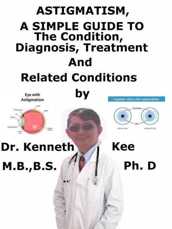 Produktbild: Astigmatism, A Simple Guide To The Condition, Diagnosis, Treatment And Related Conditions