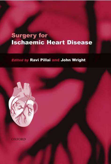 Produktbild: Surgery For Ischaemic Heart Di