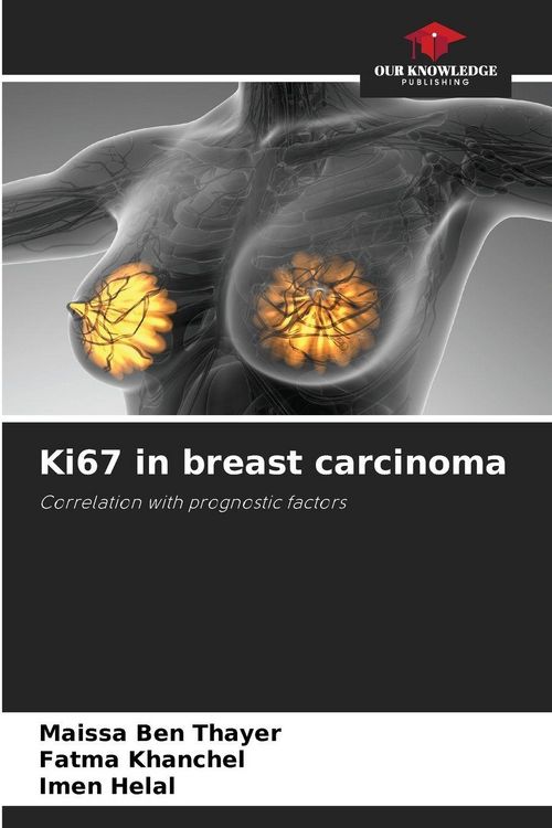 Produktbild: Ki67 in breast carcinoma
