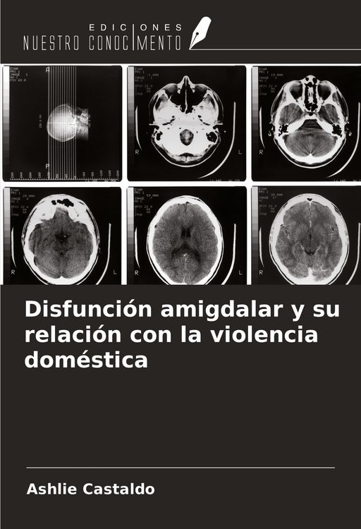 Produktbild: Disfunci&oacute;n amigdalar y su relaci&oacute;n con la violencia dom&eacute;stica