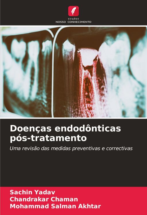 Produktbild: Doen&ccedil;as endod&ocirc;nticas p&oacute;s-tratamento