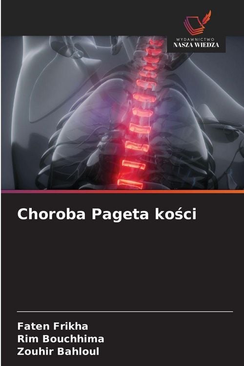 Produktbild: Choroba Pageta ko&iquest;ci