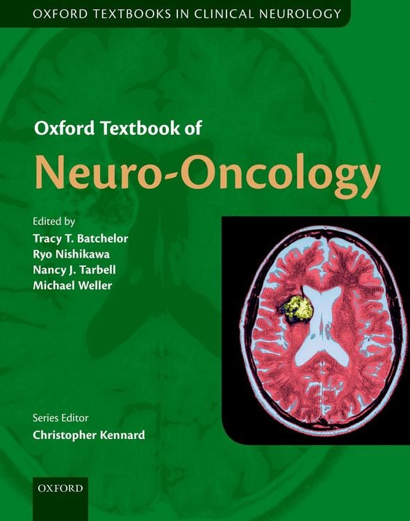 Produktbild: Oxford Textbook of Neuro-Oncology