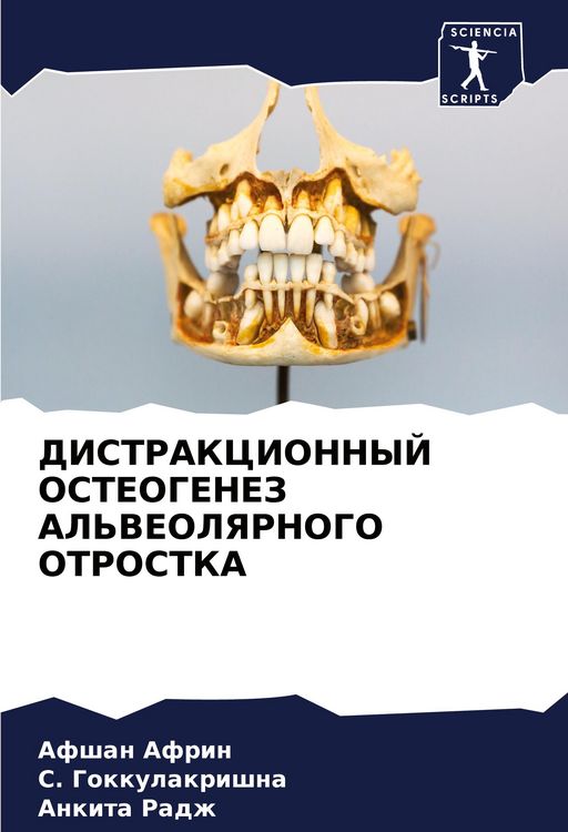 Produktbild: Distrakcionnyj Osteogenez Al'veolyarnogo Otrostka