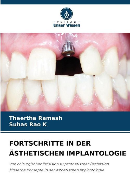 Produktbild: FORTSCHRITTE IN DER &Auml;STHETISCHEN IMPLANTOLOGIE