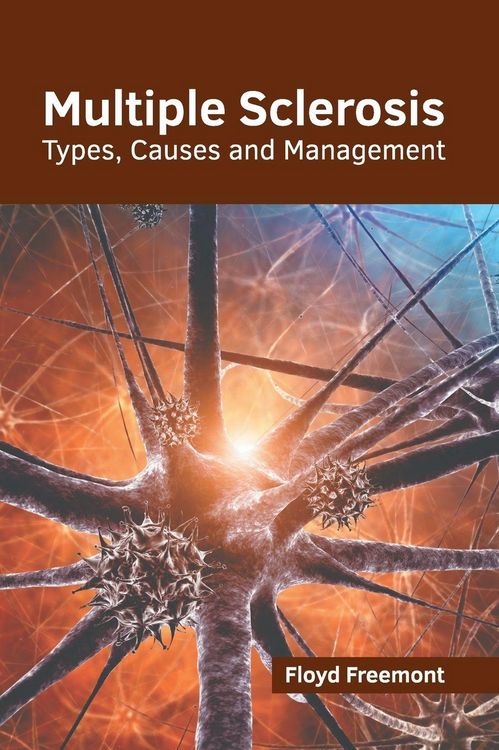 Produktbild: Multiple Sclerosis: Types, Causes and Management