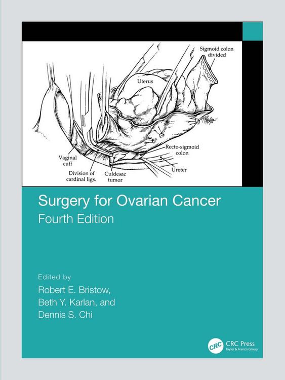 Produktbild: Surgery for Ovarian Cancer