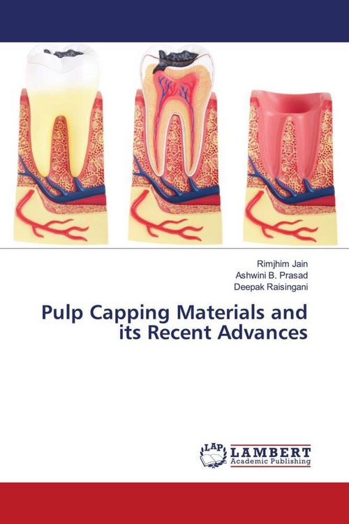 Produktbild: Pulp Capping Materials and its Recent Advances