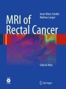 Produktbild: MRI of Rectal Cancer