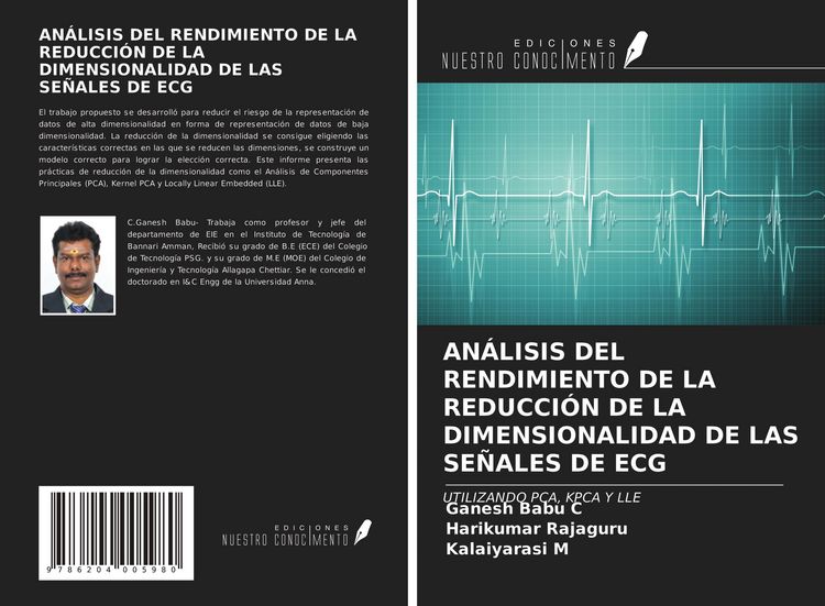 Produktbild: An&aacute;lisis Del Rendimiento De La Reducci&oacute;n De La Dimensionalidad De Las Se&ntilde;ales De Ecg