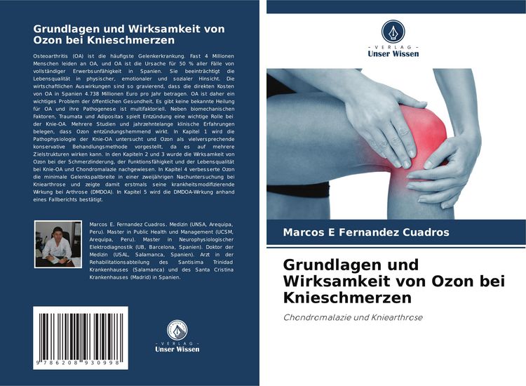 Produktbild: Grundlagen und Wirksamkeit von Ozon bei Knieschmerzen