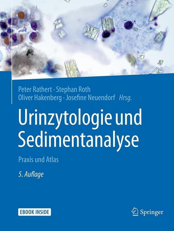 Produktbild: Urinzytologie und Sedimentanalyse