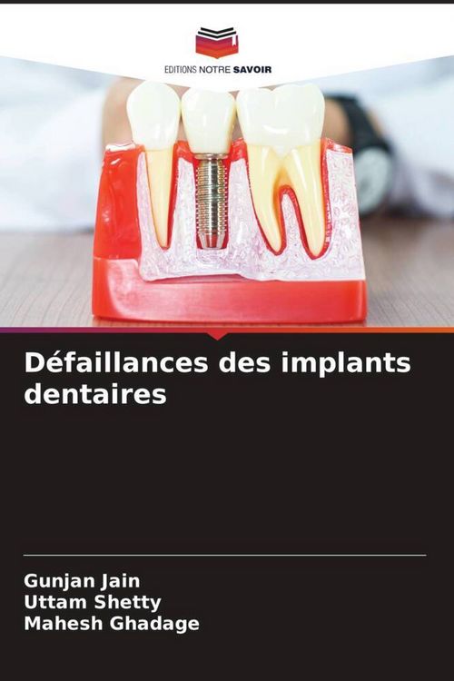 Produktbild: D&eacute;faillances des implants dentaires