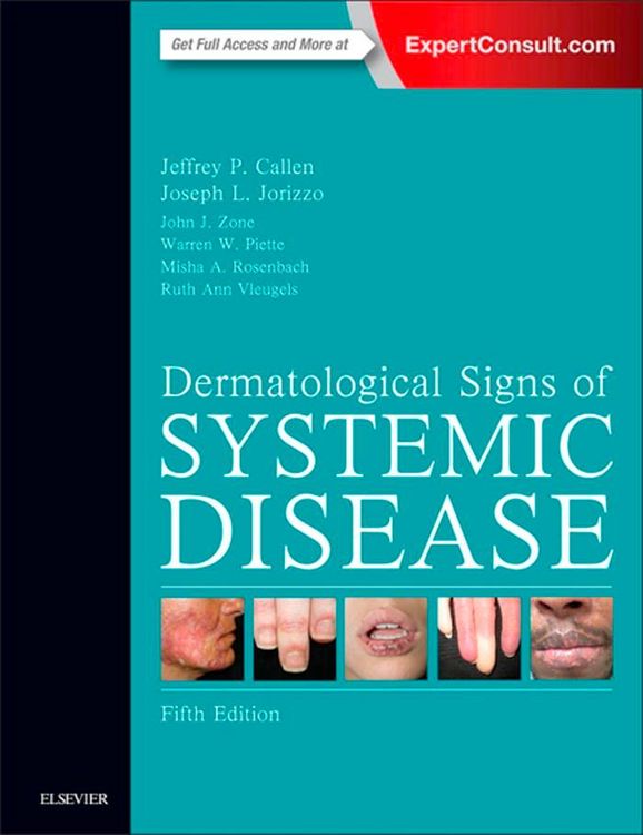 Produktbild: Dermatological Signs of Systemic Disease E-Book