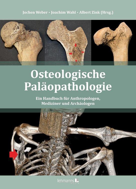 Produktbild: Osteologische Pal&auml;opathologie