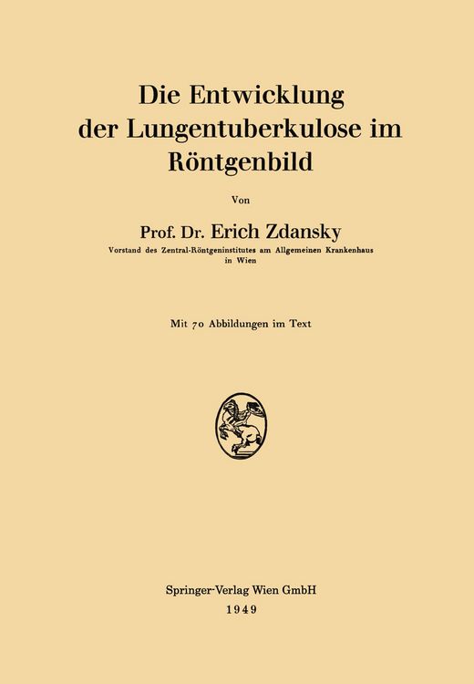 Produktbild: Die Entwicklung der Lungentuberkulose im R&ouml;ntgenbild