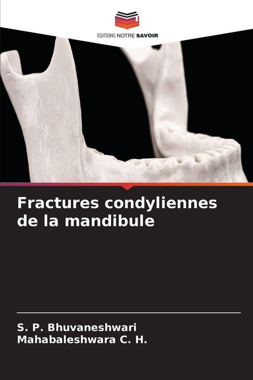 Produktbild: Fractures condyliennes de la mandibule