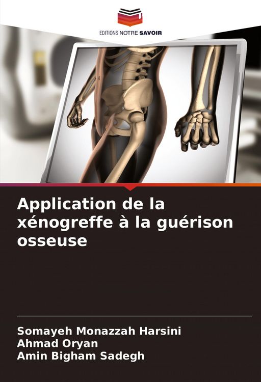 Produktbild: Application de la x&eacute;nogreffe &agrave; la gu&eacute;rison osseuse
