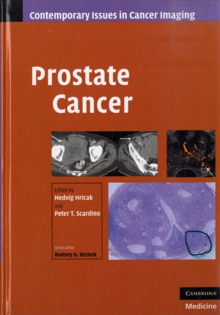 Produktbild: Prostate Cancer