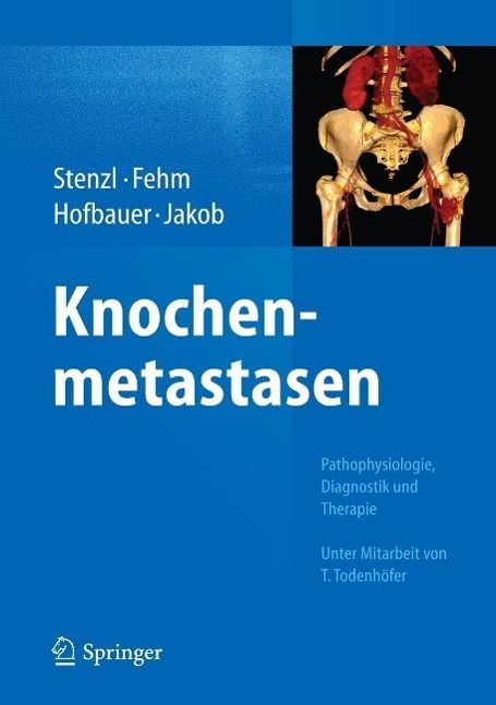 Produktbild: Knochenmetastasen