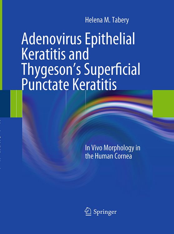 Produktbild: Adenovirus Epithelial Keratitis and Thygeson's Superficial Punctate Keratitis