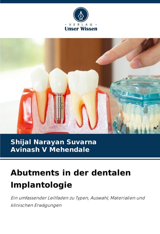 Produktbild: Abutments in der dentalen Implantologie